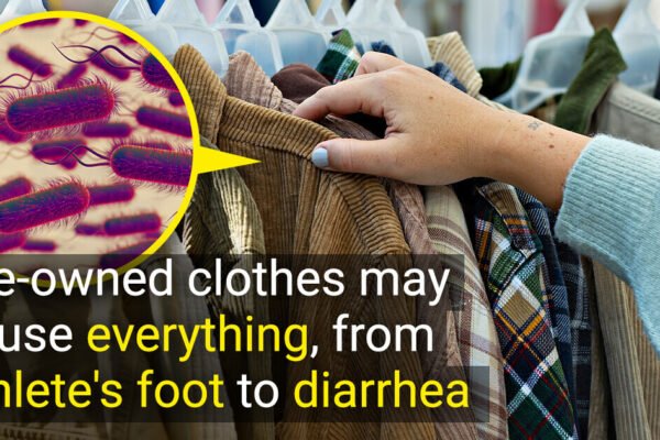 “They’re Swimming in Germs,” Scientists Give an Urgent Warning to Everyone Who Buys Vintage Second-Hand Clothes